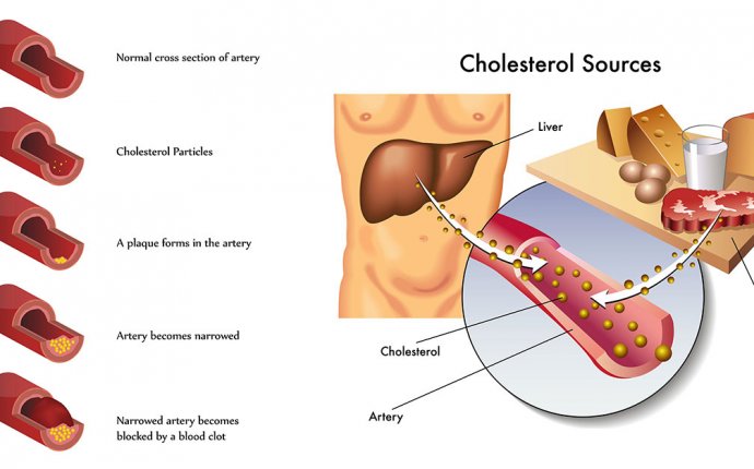 How To Lower Cholesterol Naturally?