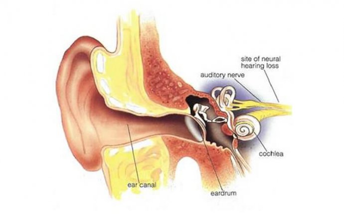 Tinnitus Ayurvedic Treatment