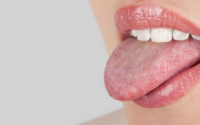 Tongue Diagnosis Ayurveda